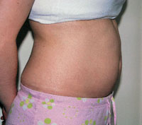 12 weeks pregnant