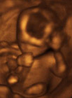 17 weeks pregnant 3D ultrasound