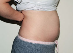 17 weeks pregnant