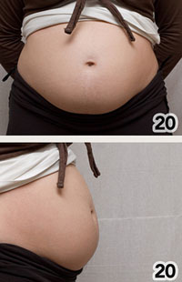 20 weeks pregnant
