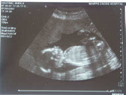 21 weeks ultra scan