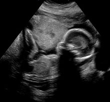 25 weeks ultrasound fetus