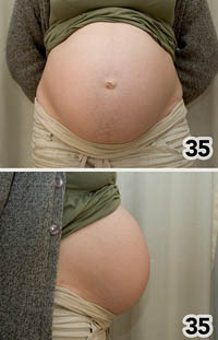 35 weeks pregnant