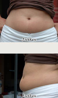 5 weeks pregnant belly