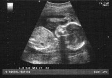 21 weeks pregnant ultrasound