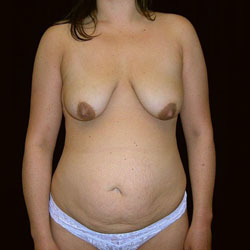 post pregnancy body
