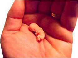 size of 8 weeks old fetus