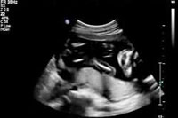 19 weeks fetus ultrasound
