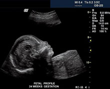 24 Weeks Pregnant - Brain Development Phase!
