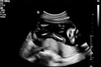 ultrasound at 19 weeks pregnant