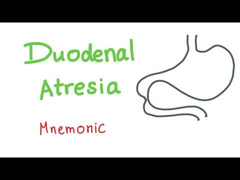 Duodenal Atresia Mnemonic