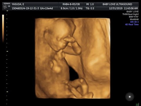 2D/3D/4D ULTRASOUND 15 weeks 4 days with GENDER REVEAL!!! (No annoying music)
