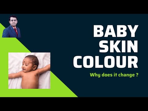 Baby Skin Colour | Why does it Change ?