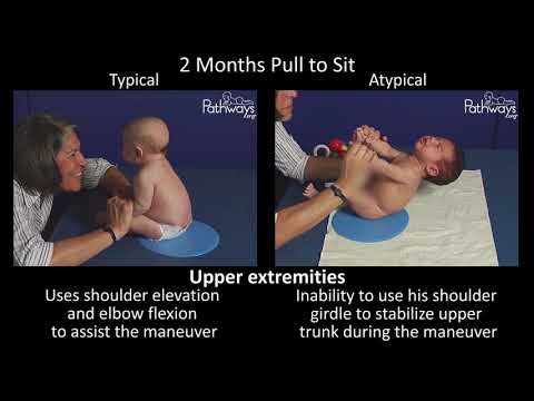 2 Month Old Baby Typical &amp; Atypical Development Side by Side