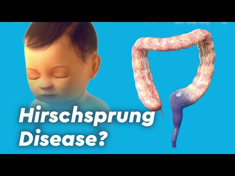Hirschsprung Disease, Colitis, and Fecal Incontinence