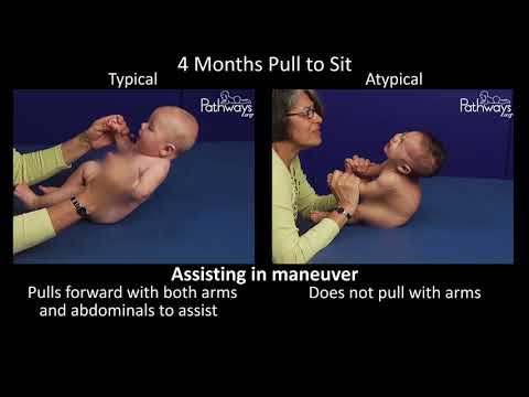 4 Month Old Baby Typical &amp; Atypical Development Side by Side
