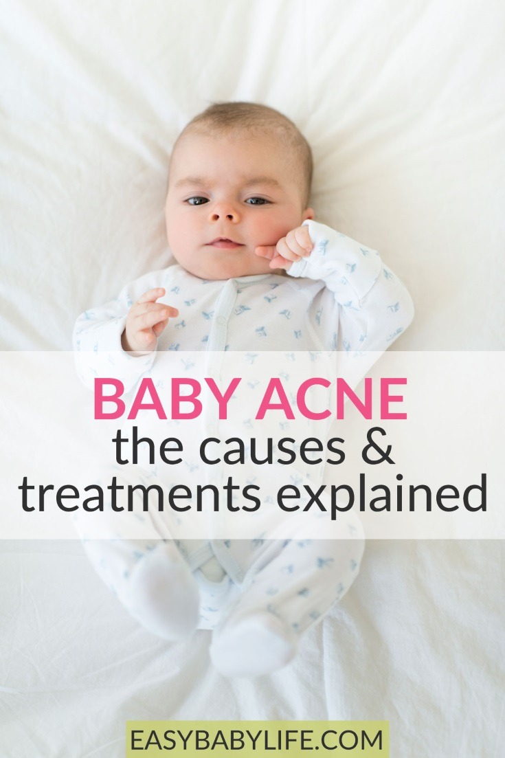 baby acne causes
