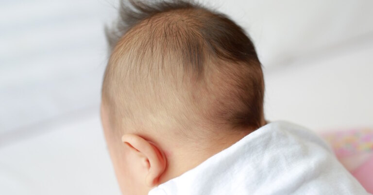 Read more about the article Help, My Baby Has Bald Spots On Her Head, Is this Normal?!