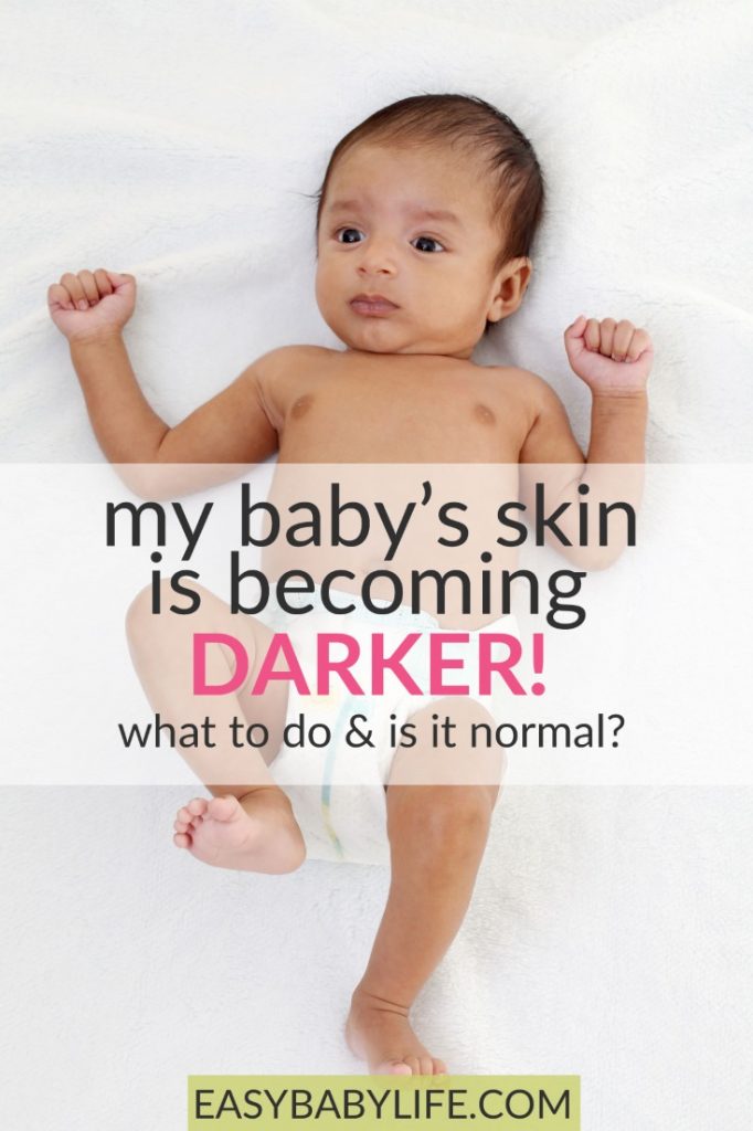 How Baby Skin Color Changes Baby's Skin Is Getting Darker!