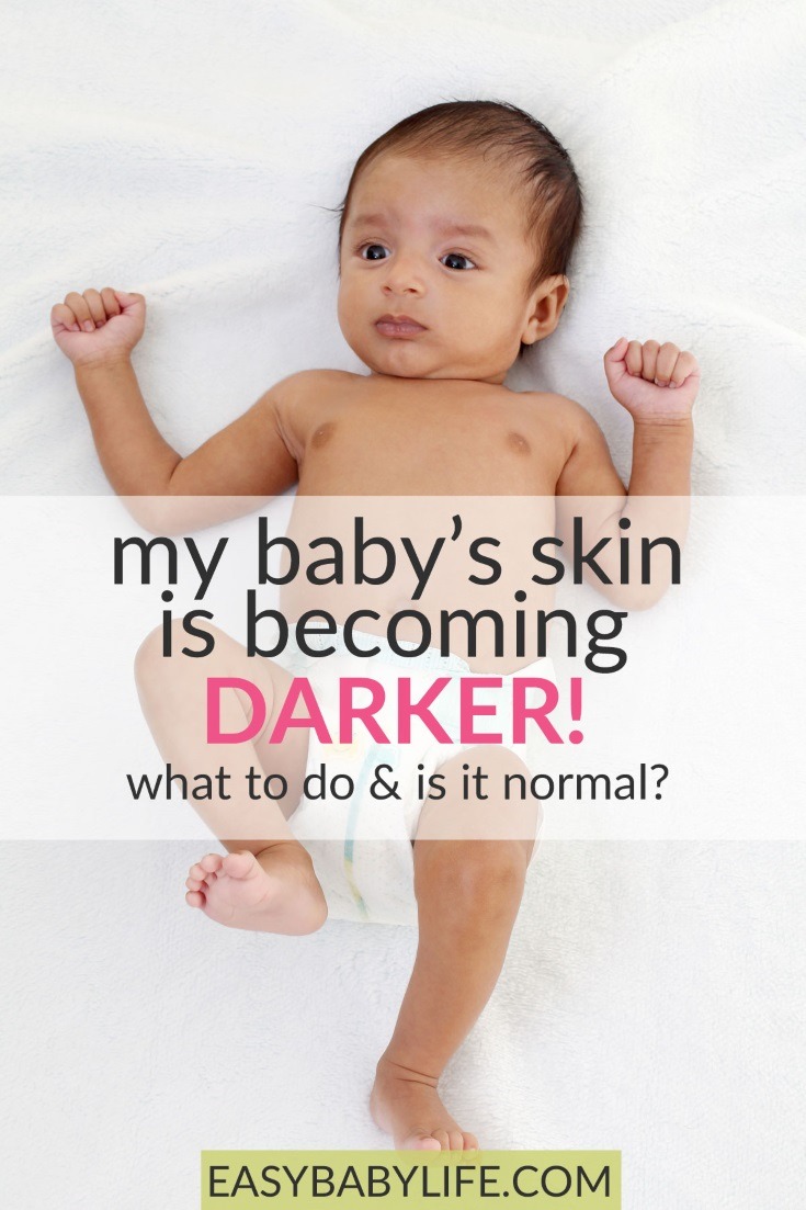 baby's skin getting darker