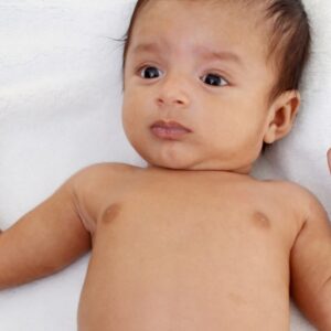 Baby Skin Color Change: Why, When it Stops, Normal and Not
