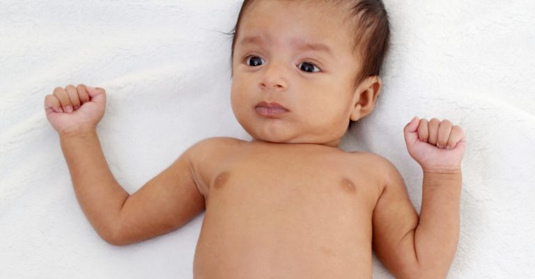 Read more about the article When Does Baby Skin Color Stop Changing? Baby Compexion FAQ