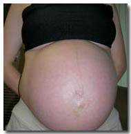 36 Weeks Pregnant Belly with linea negra