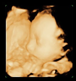 27 weeks ultrasound