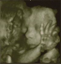 30 weeks ultrasound