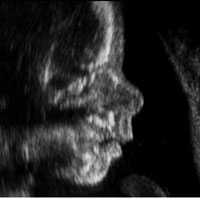 fetal face profile week 22