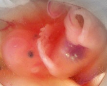 10 weeks pregnant embryo