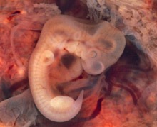 7 weeks pregnant fetus