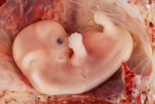 9 weeks pregnant embryo