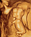 Fetus at 14 weeks pregnant