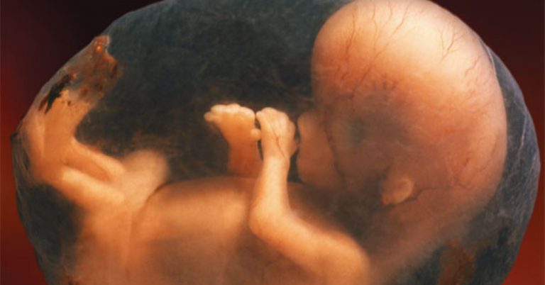 Read more about the article 5 Amazing Fetal Development Videos That Moved Me To Tears