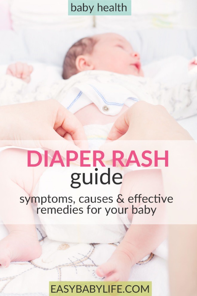 diaper rash remedies