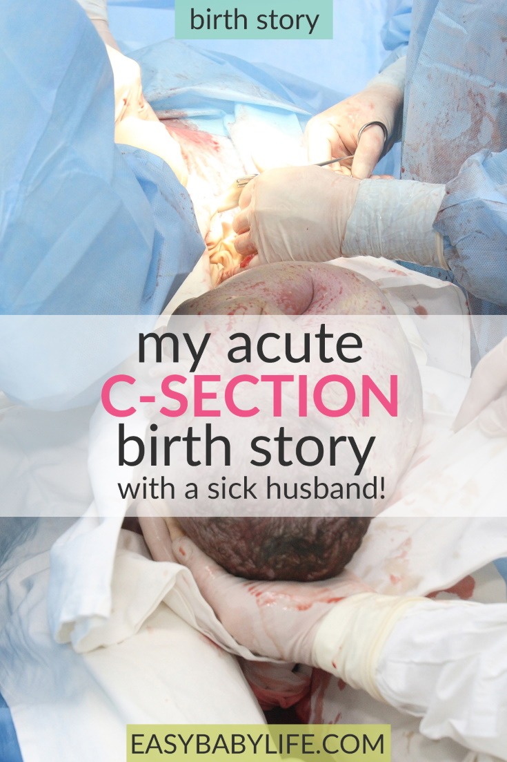 acute c-section birth story