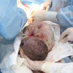 My Acute C-Section Birth Story – With a Sick Husband!