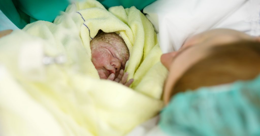 Breech presentation and c section image