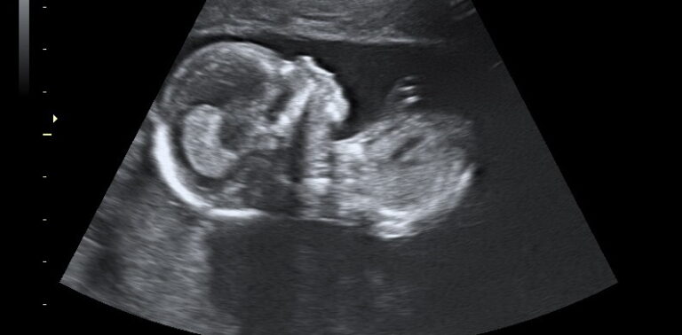 Baby Fetal Development 16 Weeks Pregnant