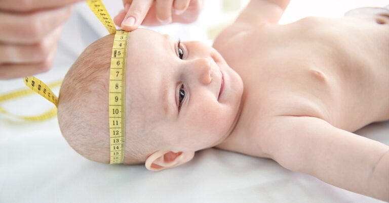 Read more about the article Baby’s Head Shape: 8 Reasons for Uneven Skull, When to Worry